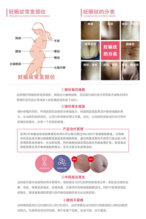 抖疤 祛疤痘坑妊娠纹