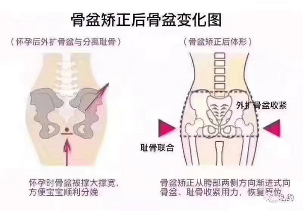 徒手整形张富源|广州徒手整形