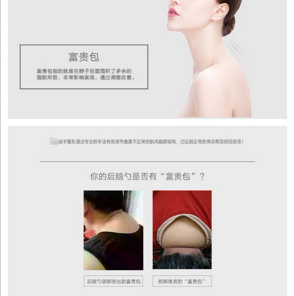 徒手整形张富源|广州徒手整形