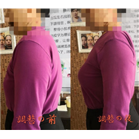台湾张富源整骨价格