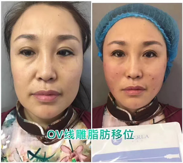 湖南线雕培训哪家好|湖南线雕培训哪家专业