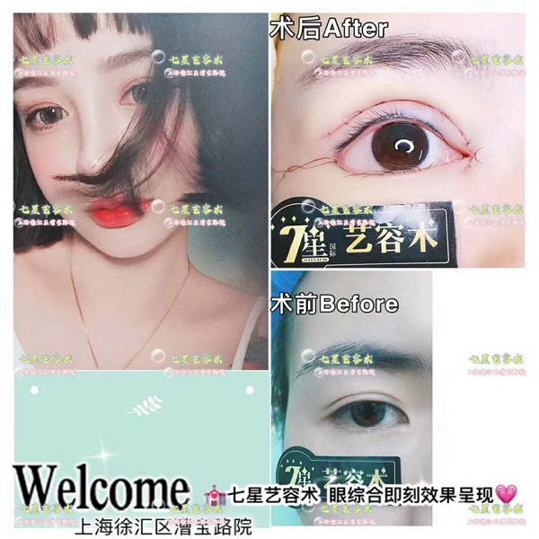 上海七星艺容术|上海七星艺容术好不好