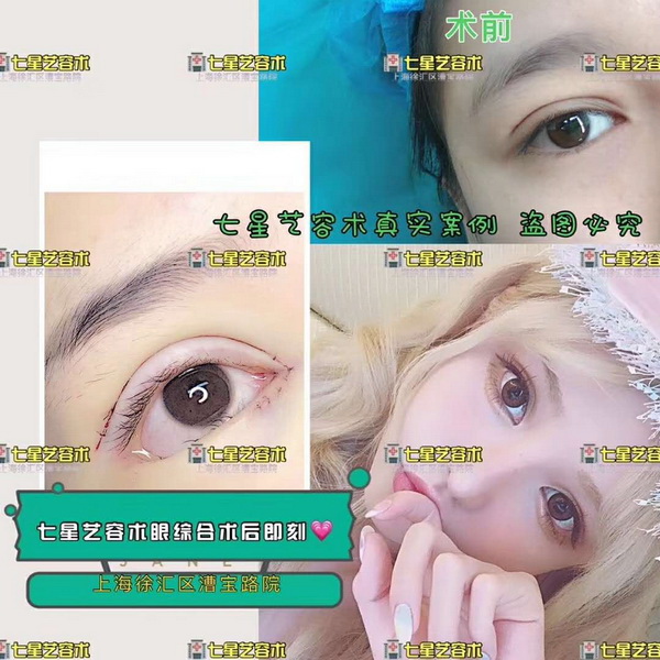上海七星艺容术|上海七星艺容术好不好