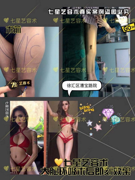 上海七星艺容术|上海七星艺容术国际整形