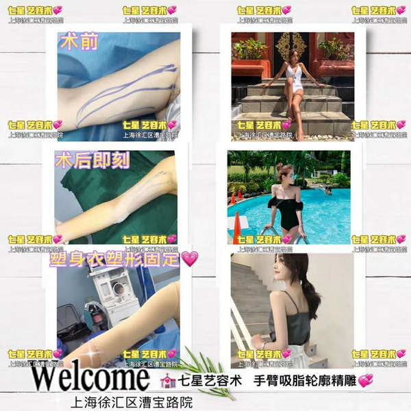 七星艺容术整形地址|上海七星艺容术