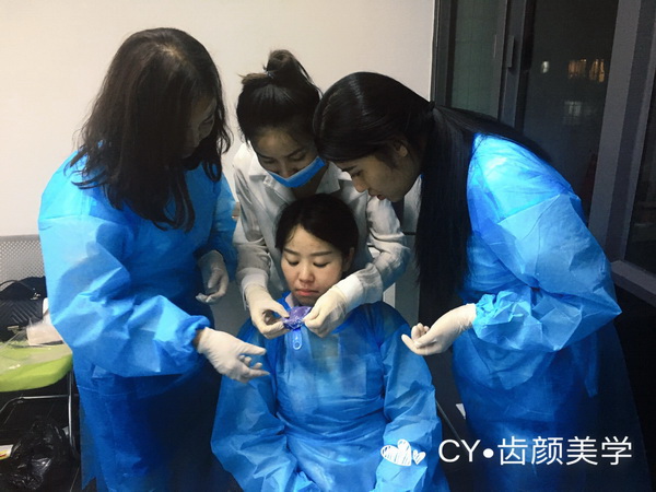 纳米树脂贴面美牙
