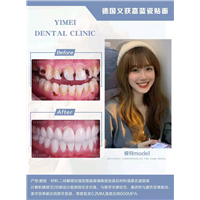 瓷贴面美牙多少钱 