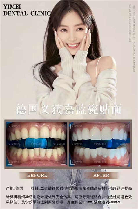 上海专业牙齿美白 