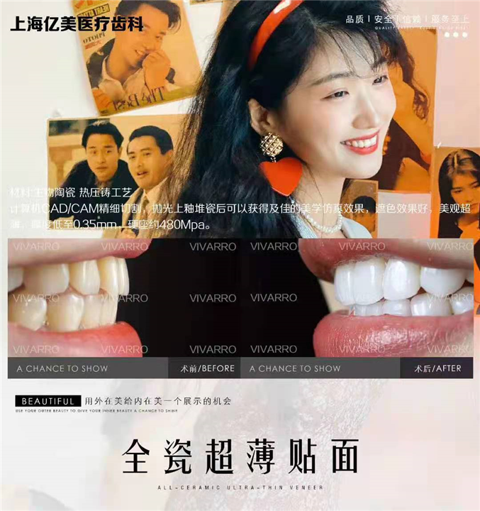 瓷化树脂贴面美牙价格 