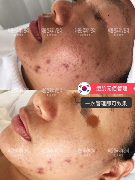 韩国星美国际皮肤管理