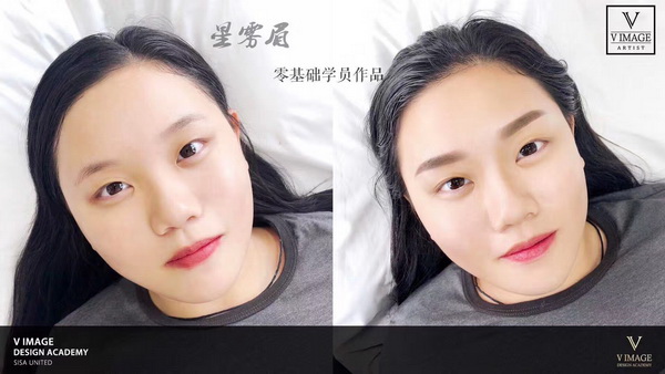 广州皮肤管理培训|广州皮肤管理加盟