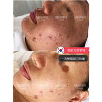 韩国星美国际皮肤管理