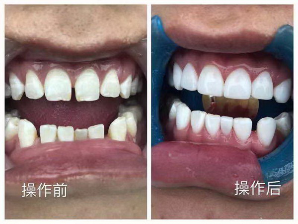 贵阳美牙培训哪家好|贵阳皮肤管理