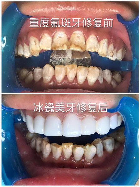 贵阳美牙培训哪家好|贵阳皮肤管理