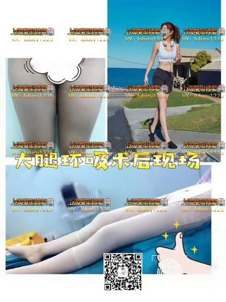 上海Facemaker修复整形