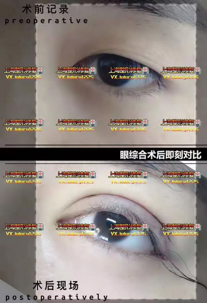 上海正规修复整形医院