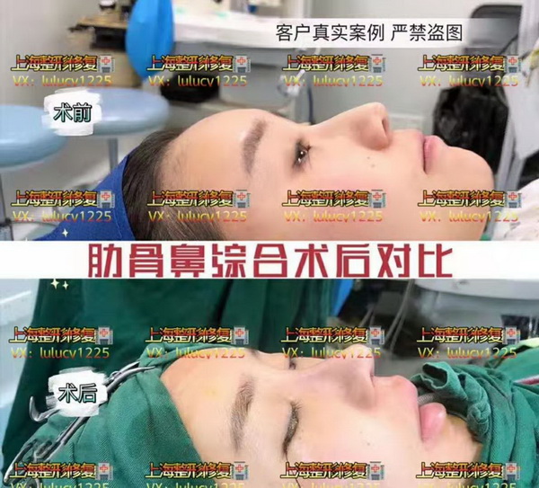 上海网红整形|上海人气网红整形