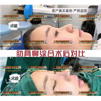 上海网红整形|上海人气网红整