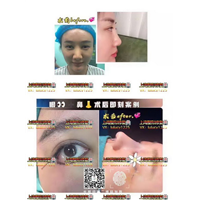 上海鼻综合整形|上海眼综合整形