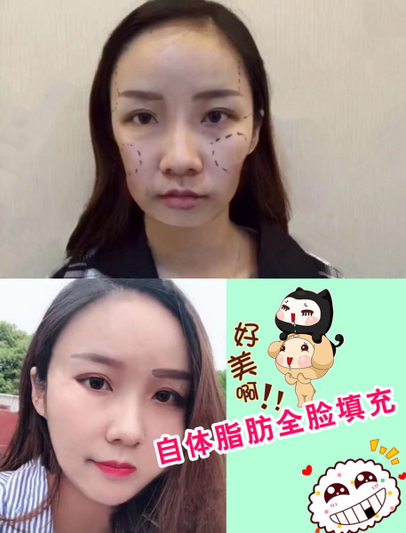 上海七星国际整形医院