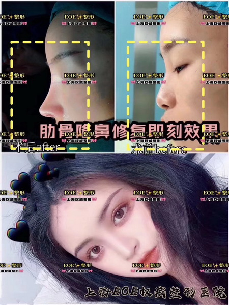 上海网红整形|上海人气网红整形