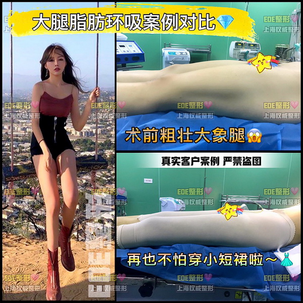 上海EOE整形地址在哪里|上海网红整形