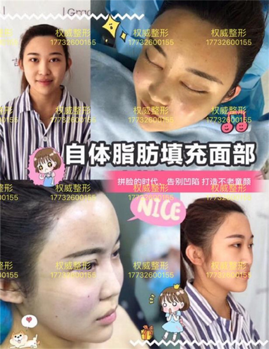 廊坊半永久 