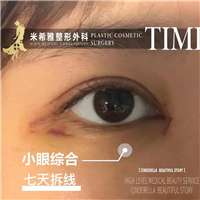 米希雅整形 