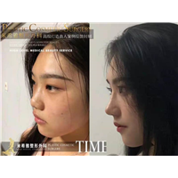 长沙米希雅整形 