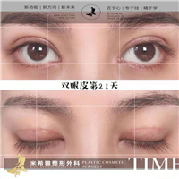 米希雅整形