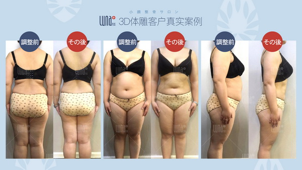 日式小颜整骨 