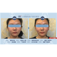 上海小颜整骨哪家好？