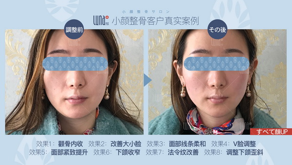 上海日式小颜整骨