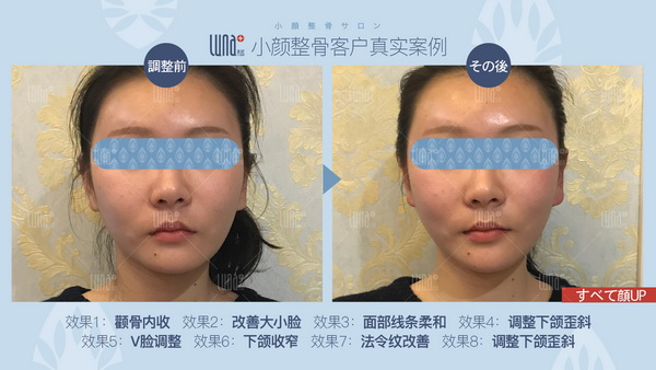 上海小颜整骨哪家好？