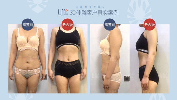 日式小颜整骨