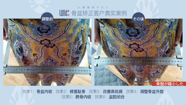 上海小颜整骨哪家好？