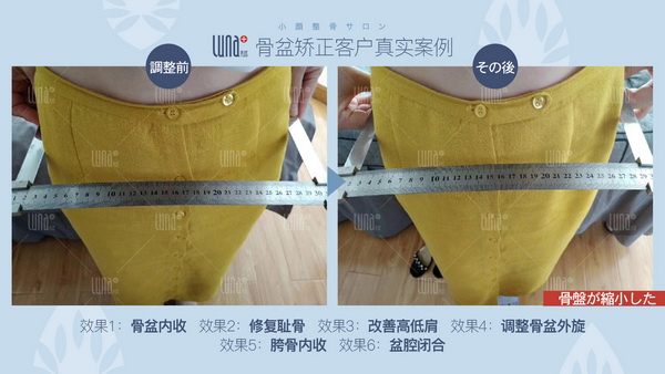 上海小颜整骨哪家好 