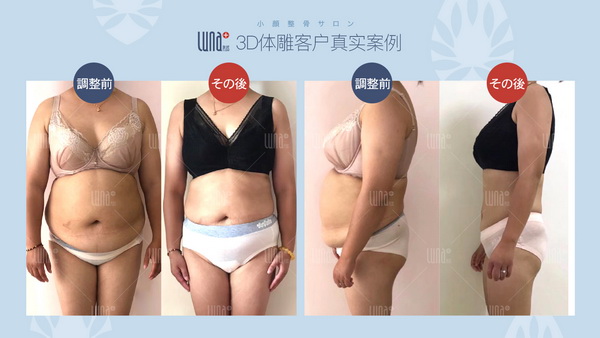 日式小颜整骨 