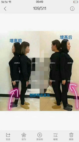 广州活细胞丰胸 