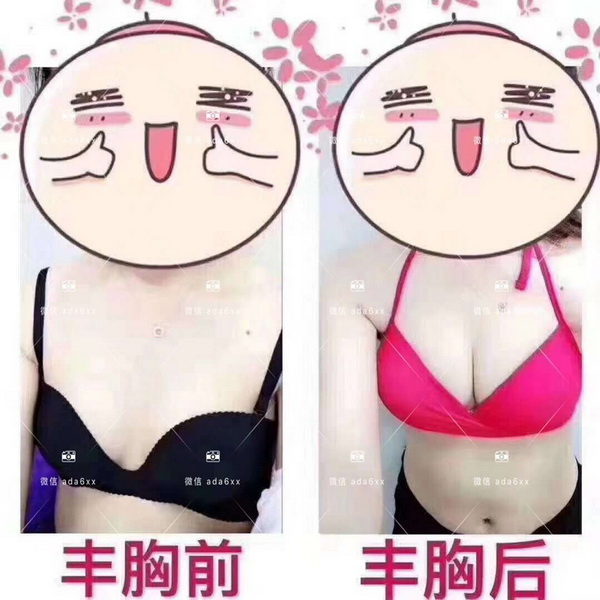 SM日式骨骼管理|广东增高整骨