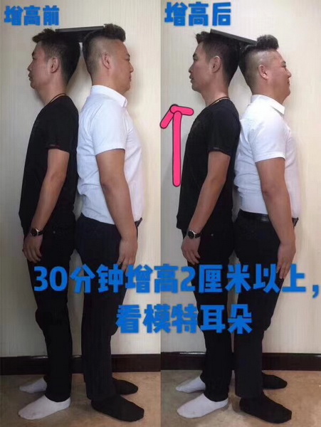 广州埋线提升 