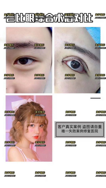 上海美学国际整形|上海美学国际整形医院