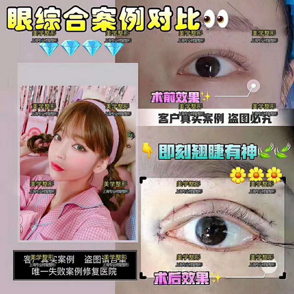 上海美学国际整形|上海美学国际整形医院