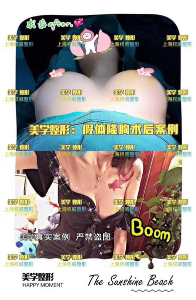 上海网红整形医院|上海微整形
