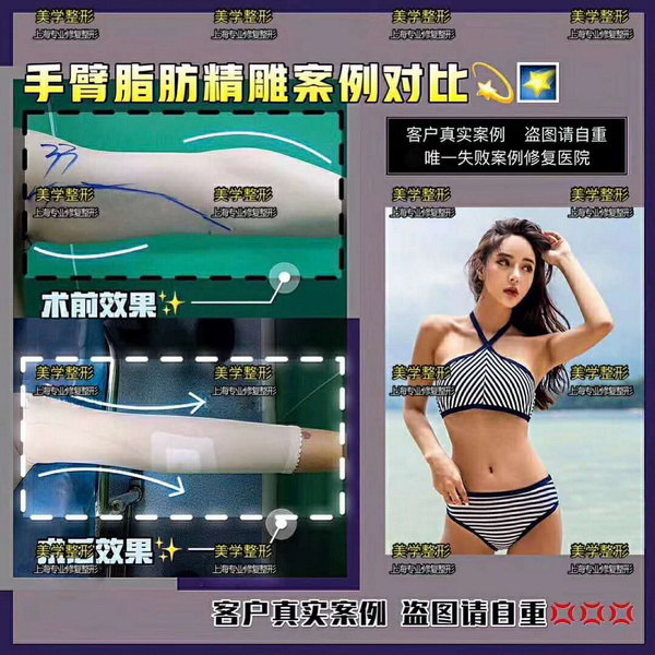 上海美学国际整形医院|上海人气网红整形