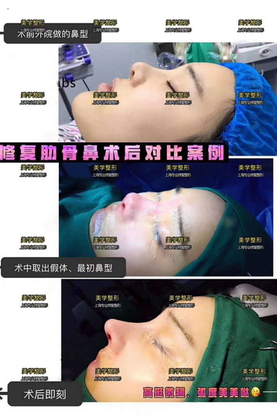 上海美学国际整形医院|上海人气网红整形