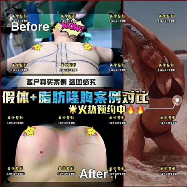 上海网红整形医院|上海微整形