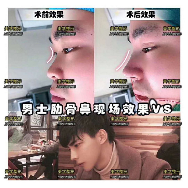 上海人气网红整形|上海网红整形医院