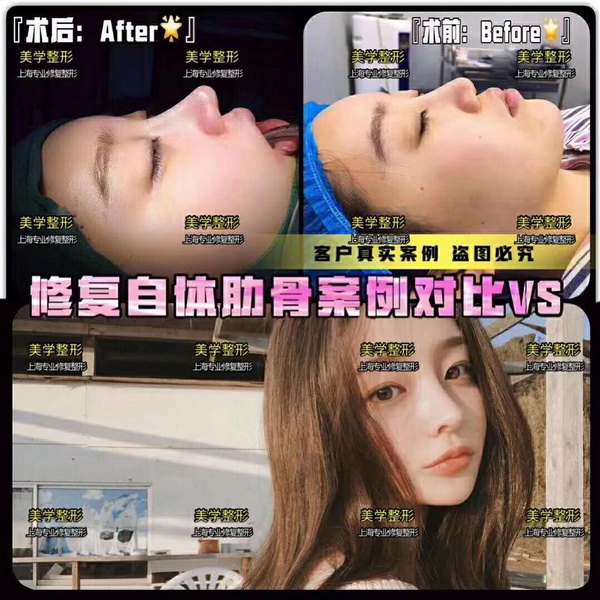 上海人气网红整形|上海网红整形医院