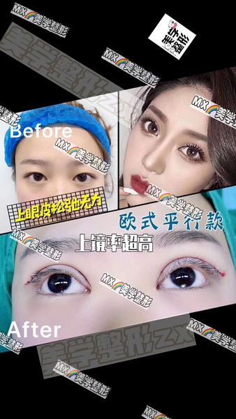 上海网红整形|上海美学国际整形